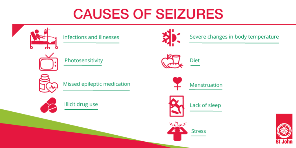 types of seizures and durations