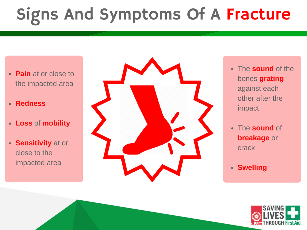 kinds-of-bone-fractures