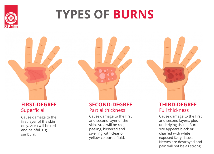 How To Treat Friction Burn Telegraph